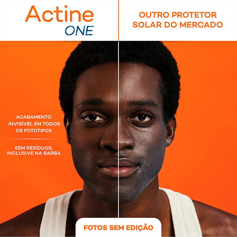 Imagem Actine One | Antes e Depois | Darrow